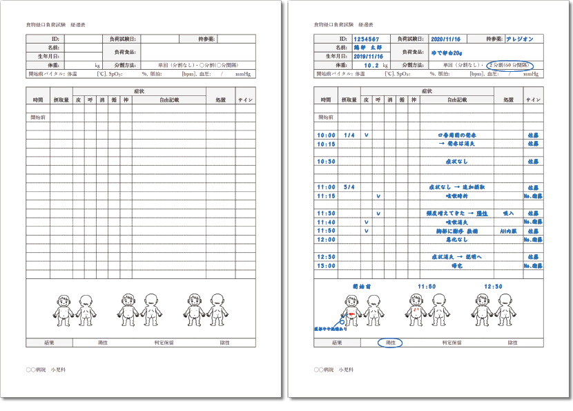 外来OFC経過表サンプル